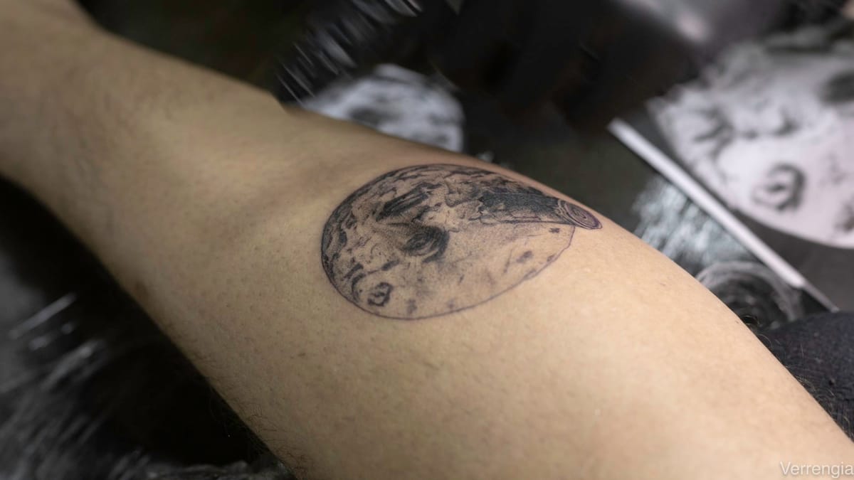 Odstraňovanie tetovania: Ako to vlastne funguje?