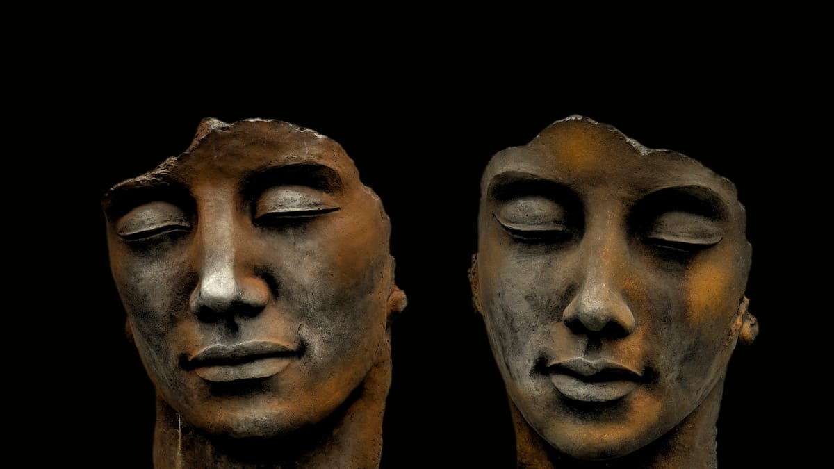 Viditeľné odlišnosti: Cesta Stacey Hussell k sebaprijatiu