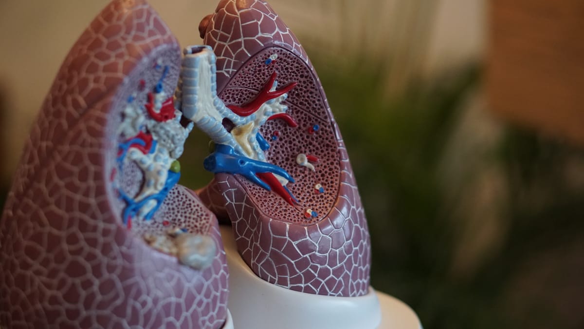 Vysvetlenie refraktórnej hypoxémie: pľúcna embólia s prietokovou prekážkou